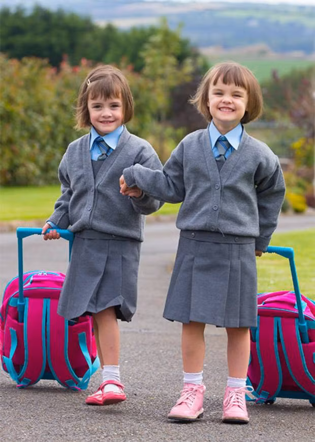 Cặp song sinh đặc biệt ấy là Amy và Katie sống ở Ireland. Mẹ của cặp song sinh này là Maria đã sinh em bé đầu tiên khi thai nhi mới được 24 tuần tuổi vào ngày 1/6/2012.