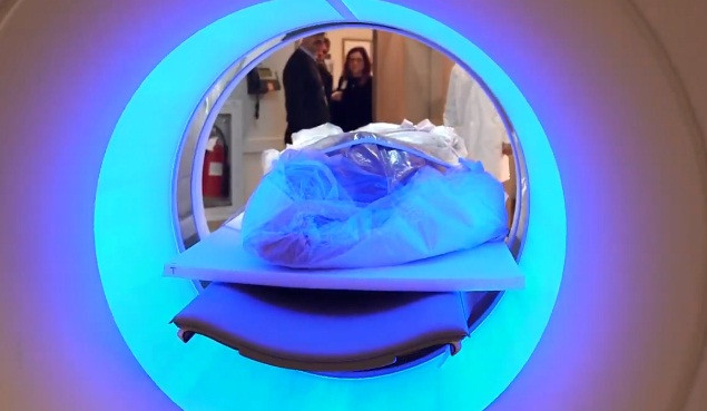 Với kết quả này, đây là lần đầu tiên các nhà khoa học tìm thấy bằng chứng xác ướp ở Greenland bị xơ vữa động mạch.