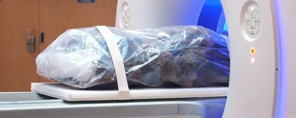 Ảnh hưởng của xơ vữa động mạch là việc vận chuyển máu trong cơ thể bị cản trở, thiếu máu nuôi các bộ phận cơ thể do động mạch chi phối. Trong số này có cả động mạch ở tim, não, cánh tay, chân, xương chậu và thận.