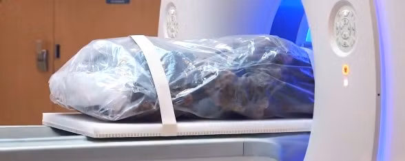 Ảnh hưởng của xơ vữa động mạch là việc vận chuyển máu trong cơ thể bị cản trở, thiếu máu nuôi các bộ phận cơ thể do động mạch chi phối. Trong số này có cả động mạch ở tim, não, cánh tay, chân, xương chậu và thận.