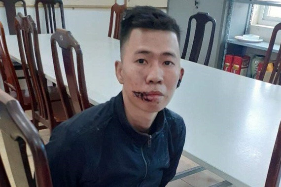 Giam dinh tam than ke giet me, chem cha bi thuong