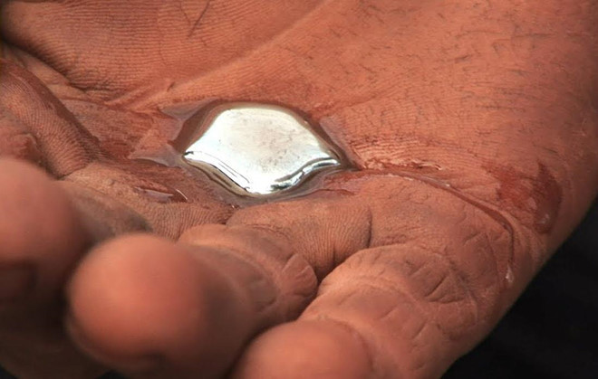 Thông thường, tình trạng ngộ độc thuỷ ngân sẽ tích tụ dần theo thời gian. Tuy nhiên, sự xuất hiện bất ngờ của bất cứ triệu chứng nào trên đây có thể là dấu hiệu của tình trạng ngộ độc cấp tính.