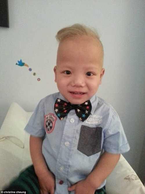 Cậu bé tóc vàng hoe khi cha mẹ đều là người châu Á, tóc đen. Do mắc phải một căn bệnh hiếm về gen nên bé Lucas, con trai của cặp vợ chồng gốc châu Á, anh Aaron và chị Christine Cheung lại sở hữu mái tóc vàng tự nhiên như của người châu Âu.