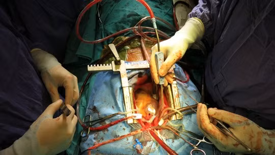 Quả tim mới nằm trong lồng ngực bệnh nhân đã đập những nhịp mới hòa hợp với cơ thể người nhận.