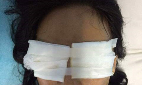 Chị Nguyễn Thị Hằng bị mẹ chồng Lê Thị An tạt axít. Ảnh: CTV