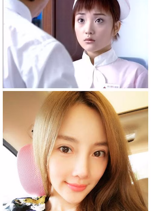 Trong những năm gần đây, Lý Tiểu Lộ liên tục vướng nghi vấn phẫu thuật thẩm mỹ. Ảnh: Weibo