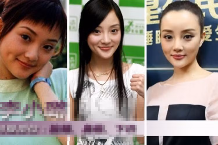 Lý Tiểu Lộ sở hữu đôi mắt to hơn và mí nhấn sâu hơn. Ảnh: Sohu