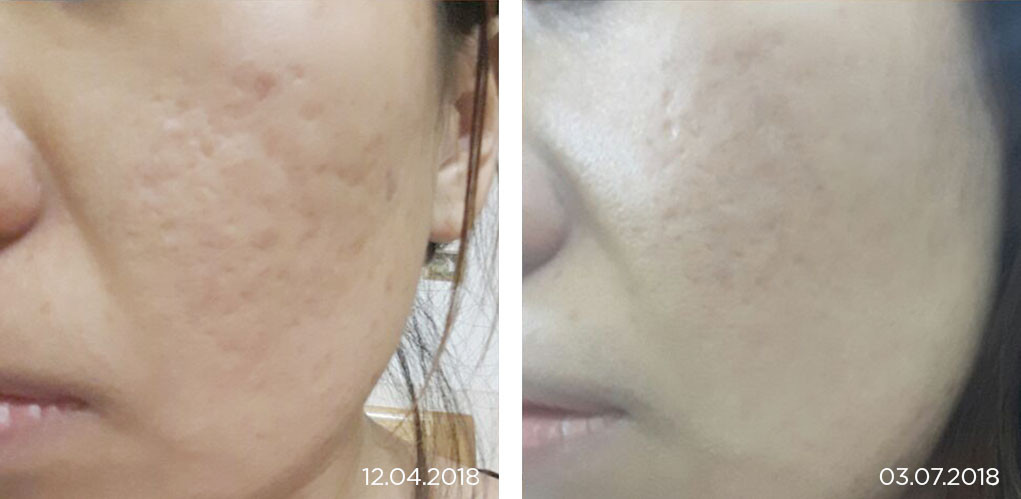 Serum seo ro cua La House co that su hieu qua?-Hinh-5