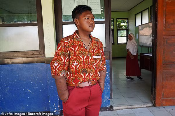 Nhờ nỗ lực luyện tập và ăn kiêng khắt khe, cậu bé nặng nhất thế giới giảm tới hơn 100kg. Sau khi giảm cân ngoạn mục, hiện tại Arya nặng hơn 80kg. So với bạn bè, ngoại hình Arya vẫn có sự khác biệt song nỗ lực giảm cân của cậu được đánh giá cao.