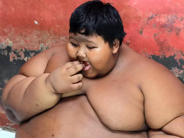  Cậu bé nặng nhất thế giới Arya Permana sống tại ngôi làng Cipurwasari (tỉnh Tây Java, Indonesia). Cách đây 4 năm, Arya được ghi nhận là đứa trẻ béo nhất thế giới với trọng lượng 192kg khi mới 10 tuổi.