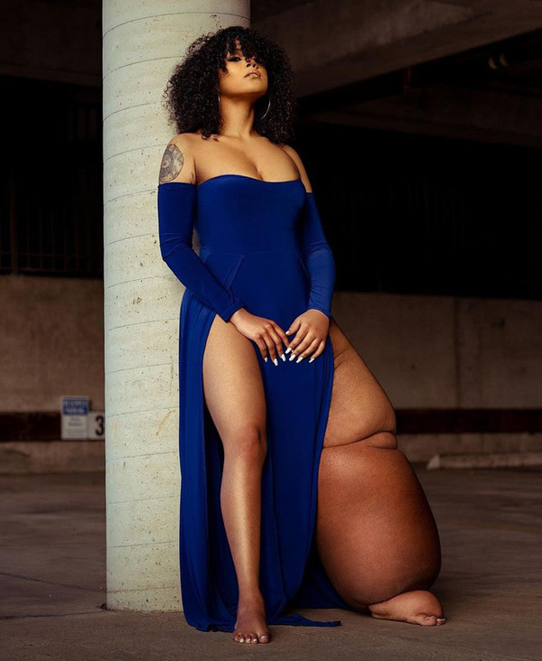 Sau đó, tôi nhận được sự hỗ trợ từ cộng đồng phù bạch huyết trực tuyến, mẹ cũng truyền cảm hứng cho tôi. Mẹ giúp tôi nhận ra mình xinh đẹp như thế nào".