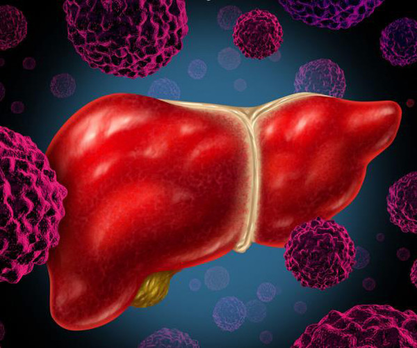 Sau khi kiểm tra, bác sĩ chẩn đoán A Ngô mắc ung thư gan. Nghe tin sét đánh, vợ Ngô không tin vào tai mình. Bà gặng hỏi bác sĩ tại sao chồng đang khỏe mạnh bỗng dưng đổ bệnh. Bình thường, A Ngô cũng không bỏ bê sức khỏe, thi thoảng lắm mới uống rượu.