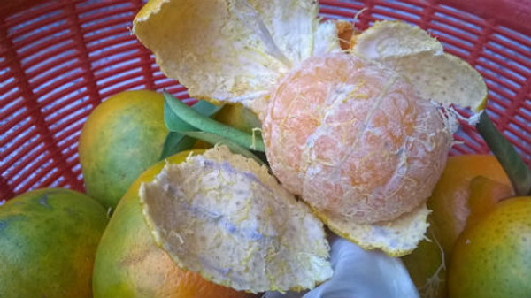 Thông qua trường hợp bệnh của A Ngô, bác sĩ nhấn mạnh dấu hiệu thường gặp của ung thư gan. Nếu xuất hiện triệu chứng không rõ nguyên nhân, bạn nên đi khám sớm để phát hiện và điều trị kịp thời.