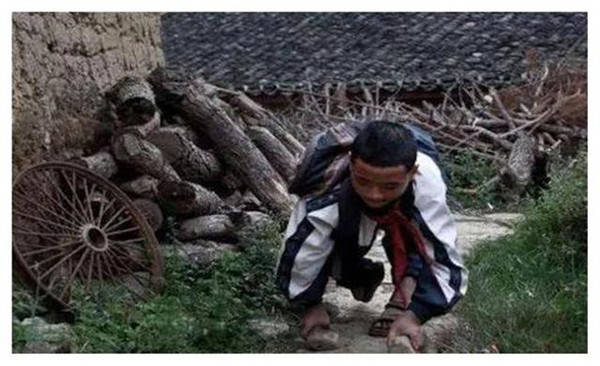 Người dân nơi đây cũng cho biết, họ không cảm thấy bất tiện với tư thế di chuyển này. Thậm chí tốc độ của họ cũng tương đương với việc đi bộ bình thường. Nếu tăng tốc, họ cũng không thua kém với việc chạy bộ.