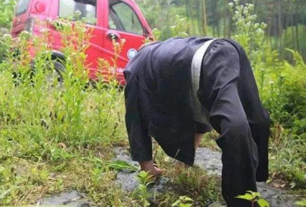 Ban đầu, các nhà khoa học đưa ra giả thuyết tình trạng bắt nguồn từ đột biến gen và ảnh hưởng của chất phóng xạ song không thuyết phục.