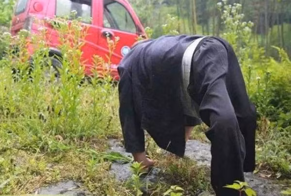 Ban đầu, các nhà khoa học đưa ra giả thuyết tình trạng bắt nguồn từ đột biến gen và ảnh hưởng của chất phóng xạ song không thuyết phục.