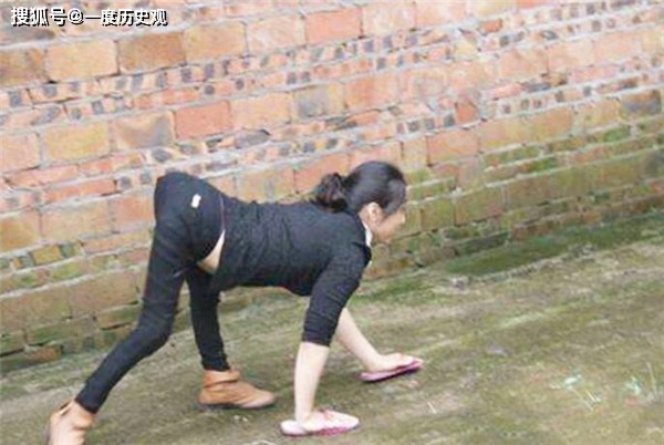 Dù vậy, một điểm khiến giới nghiên cứu băn khoăn là ngay cả những đứa trẻ sinh ra khỏe mạnh cũng có tư thế di chuyển này.