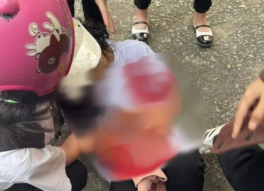 Quảng Ninh: Mâu thuẫn, nữ sinh lớp 10 đâm 2 bạn học nhập viện Quang Ninh: Mau thuan, nu sinh lop 10 dam 2 ban hoc nhap vien