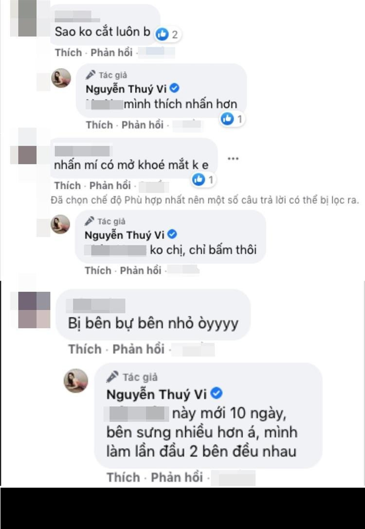 Thay vì nhận về lời khen, lần chỉnh sửa nhan sắc này Thúy Vi lại bị chê nhiều hơn. Bỏ ra một khoản tiền để làm đẹp nhưng nhiều người tinh ý nhận ra mắt của cô nàng không đều nhau, bên to bên nhỏ.