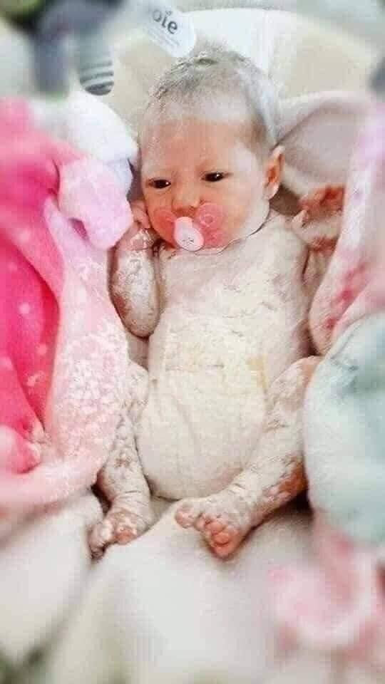 Theo những hình ảnh được đính kèm, cô chị rất nghiêm túc dùng hộp phấn rôm bôi trát lên người cho em từ đầu tới chân. Trong khi đó, em bé thì mặt chẳng thể hiện chút cảm xúc nào, nằm im ngậm ti giả trong nôi.