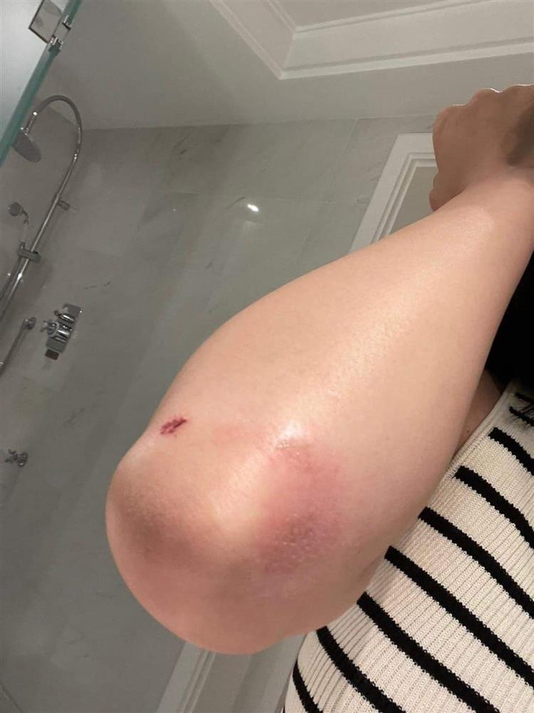 Dù Lily Chen không chỉ đích danh ai, song không ít người cho rằng cô đang ám chỉ "nữ hoàng nội y" nào đó.