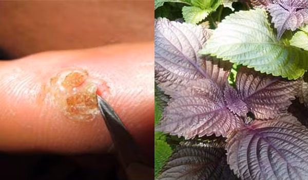 Tía tô là một loại thảo dược quen thuộc trong các bài thuốc Đông y, có khả năng điều trị rất nhiều bệnh - Ảnh: Internet. Tía tô là một loại thảo dược quen thuộc trong các bài thuốc Đông y, có khả năng điều trị rất nhiều bệnh - Ảnh: Internet.