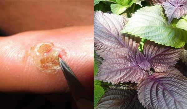 Tía tô là một loại thảo dược quen thuộc trong các bài thuốc Đông y, có khả năng điều trị rất nhiều bệnh - Ảnh: Internet.