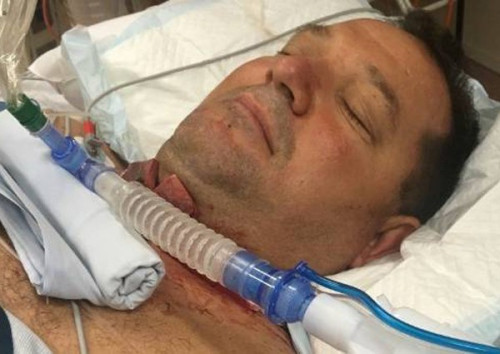 Nhờ được bạn gái mở cuống họng kịp thời mà ông Bester đã thoát chết vì nghẹn thức ăn.