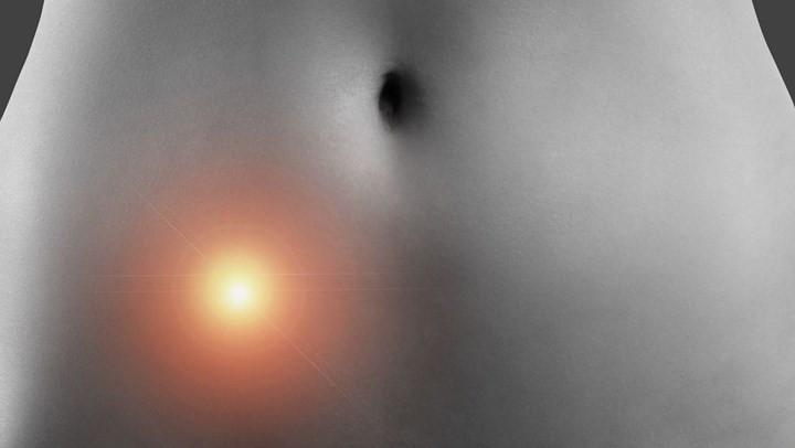 Bị lạc nội mạc tử cung: Bạn có nguy cơ ung thư buồng trứng nếu bạn bị lạc nội mạc tử cung, một tình trạng nội mạc tử cung (mô) phát triển bên ngoài tử cung thay vì ở lớp lót bên trong tử cung và thường gây ra đau đớn.