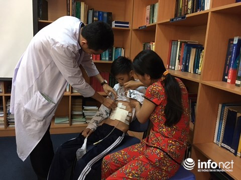 Bệnh nhi đang hồi phục sau ca mổ tái tạo dạ dày.