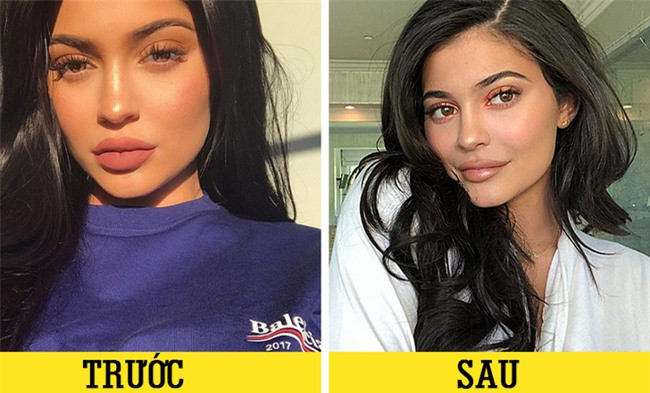  4. Tiêm filler Nếu tiêm filler không cẩn thận và không đúng vị trí, có thể để lại nhiều hậu quả không lường được như da bị bầm tím, nổi u, tạo thành những cục bất thường trên da. Nếu bạn muốn đôi môi quyến rũ hơn, bạn có thể học cách tô son để môi trông dày hơn chứ không nhất thiết phải tiêm filler, vừa tốn kém lại vừa nguy hiểm. 