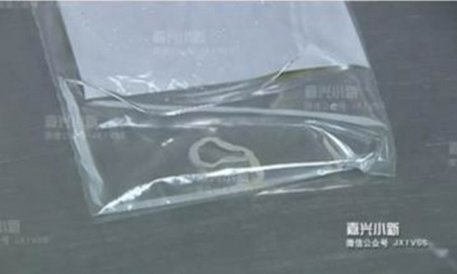 Con sơ mít dài 13cm sau khi được lấy ra từ cơ thể bệnh nhân Diêu. Ảnh: Báo Tin tức Hàng Châu.