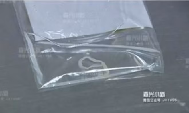 Con sơ mít dài 13cm sau khi được lấy ra từ cơ thể bệnh nhân Diêu. Ảnh: Báo Tin tức Hàng Châu.