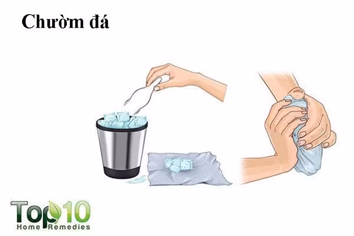 Chườm đá lên ngón tay bị bong gân có thể giúp giảm sưng, viêm và đau. Cách này cũng làm ngừng chảy máu từ dây chằng bị rách. Nên chườm đá trong 48 đến 72 giờ đầu tiên sau khi bị thương.