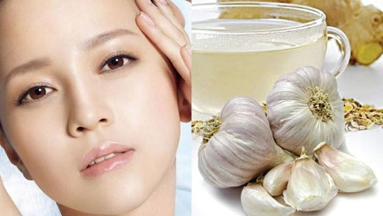 Bạn hoàn toàn có thể trị sạch mụn đầu đen bằng tỏi (Ảnh minh họa).