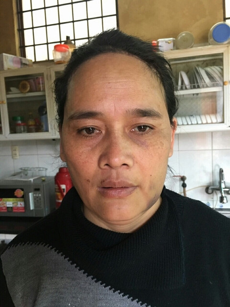 Chị Thanh với mái tóc bị cắt nham nhở.