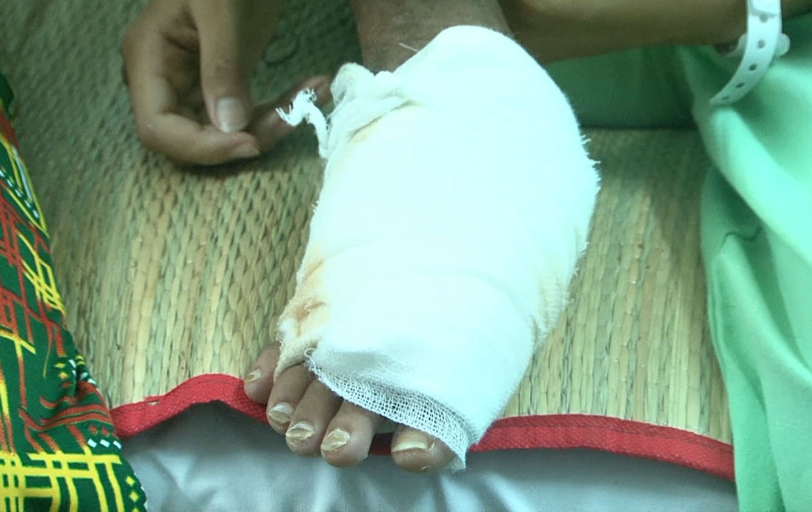 Bé gái phải trải qua ít nhất 2 cuộc phẫu thuật.