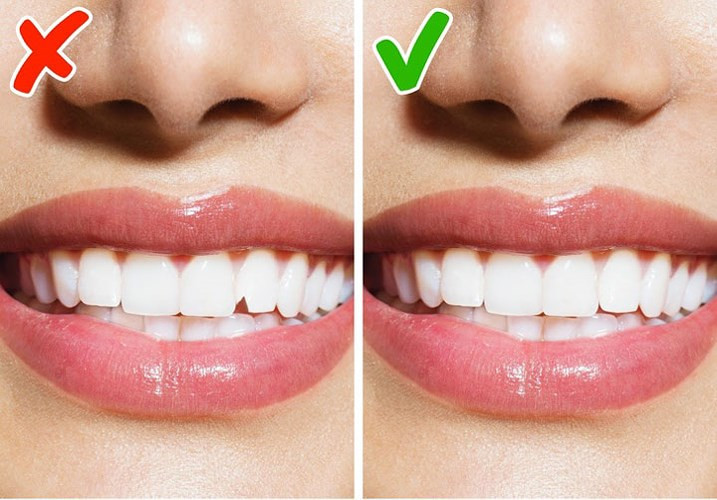 Răng: Người Việt quan niệm: "Cái răng, cái tóc là góc con người". Vậy nên, khỏe mạnh và đẹp là một trong những yếu tố quan trọng đảm bảo sự tự tin. Bạn nên kiểm tra răng thường xuyên và ở một địa chỉ uy tín.