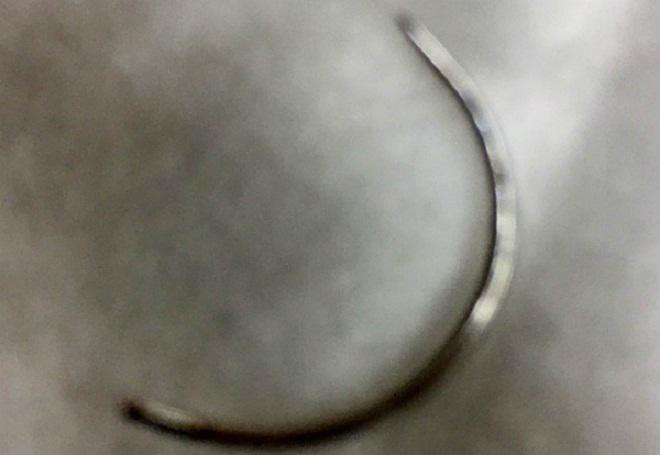 Các bác sĩ tại Bệnh viện Từ Dũ đã gắp cây kim từ trong người sản phụ ra ngoài. Các bác sĩ tại Bệnh viện Từ Dũ đã gắp cây kim từ trong người sản phụ ra ngoài.