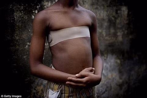 Những gia đình giàu có thường quấn dải băng quanh ngực con gái để hạn chế sự phát triển của ngực.