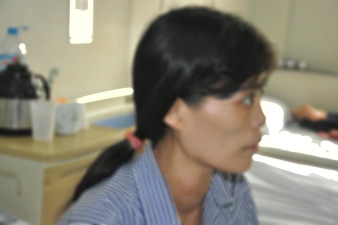 Sau khi chữa bằng thuốc Nam, cổ chị N. nhăn nhúm với các vết sẹo lớn do hoại tử da.