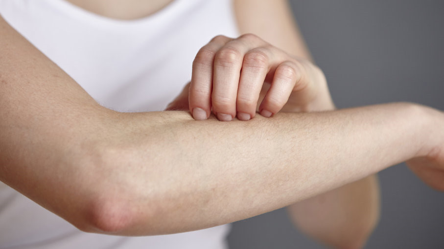 Dị ứng nước: Một số người bị dị ứng nước, trong đó da họ xuất hiện các vệt đỏ và nổi mẩn ngứa khi tiếp xúc với nước. Nguyên nhân của chứng bệnh dị ứng hiếm gặp này vẫn chưa được tìm ra. Ảnh: BrainStuff.