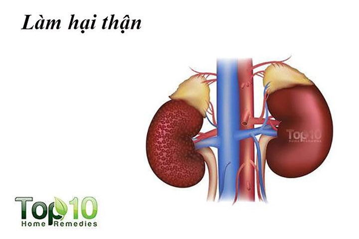 Làm hại thận: Cơ thể bạn cần một lượng nhỏ natri (muối) để duy trì sự cân bằng chất lỏng thích hợp. Nhưng dư thừa natri có thể gây hại cho thận của bạn. Ăn mặn dẫn đến lượng muối dư thừa khiến thận giữ nước để pha loãng chất điện phân này trong máu, nó sẽ ảnh hưởng đến chức năng thận.