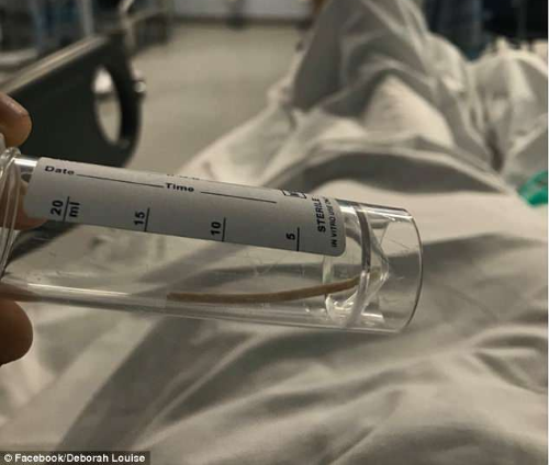 Vì chiếc que có kích thước nhỏ, nên rất dễ "đi lạc" trong cơ thể.