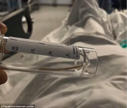 Vì chiếc que có kích thước nhỏ, nên rất dễ "đi lạc" trong cơ thể. Vì chiếc que có kích thước nhỏ, nên rất dễ "đi lạc" trong cơ thể.