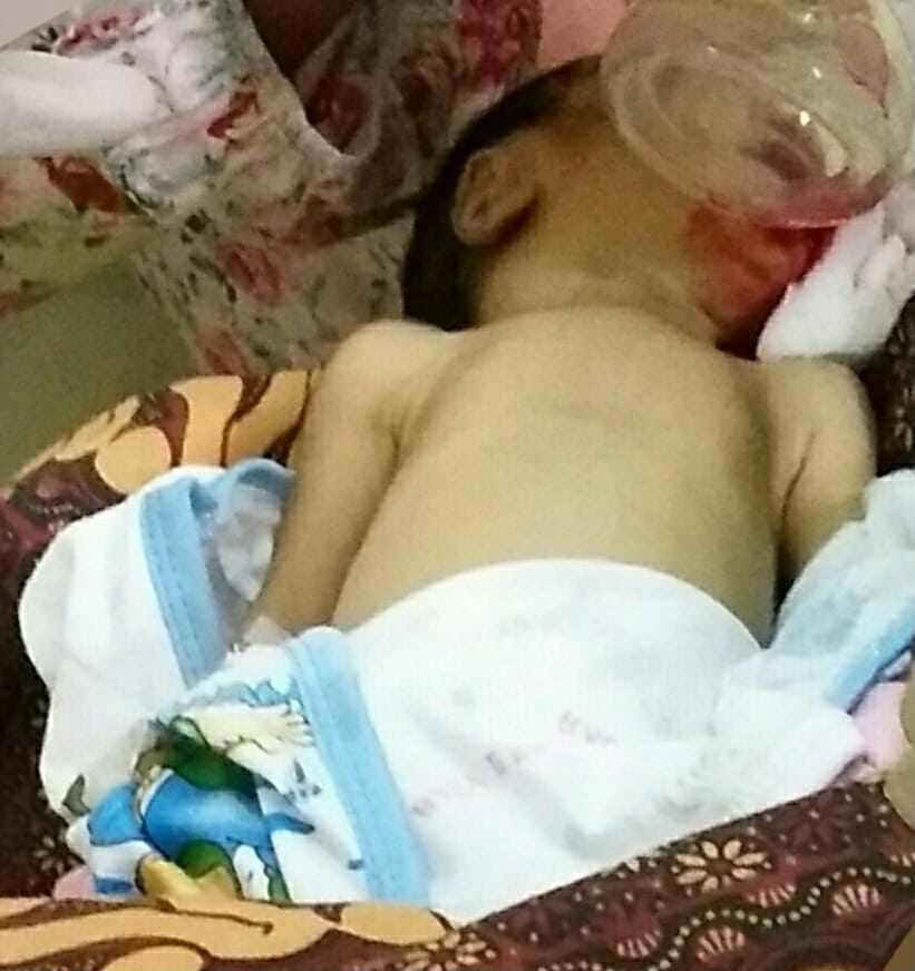 Bé trai 10 ngày tuổi thiệt mạng vì ăn cháo chuối. (Ảnh: Lia's Facebook).