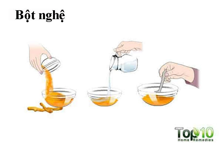 Củ nghệ là một loại thuốc giảm đau tuyệt vời do đặc tính chống viêm của nó. Bạn có thể sử dụng gia vị nhà bếp này để điều trị ngón tay bị bong gân. Chứa chất chống co thắt, nghệ cũng thư giãn các cơ và mô và giúp giảm sưng và đau.