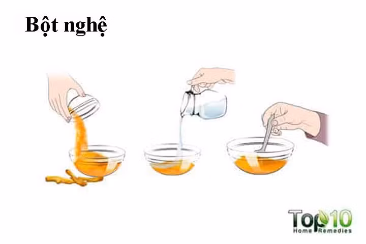 Củ nghệ là một loại thuốc giảm đau tuyệt vời do đặc tính chống viêm của nó. Bạn có thể sử dụng gia vị nhà bếp này để điều trị ngón tay bị bong gân. Chứa chất chống co thắt, nghệ cũng thư giãn các cơ và mô và giúp giảm sưng và đau.