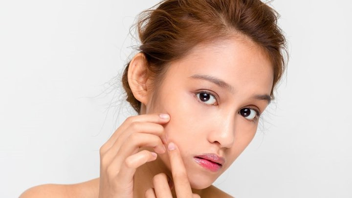 Mụn trứng cá: Rau là nguồn cung cấp vitamin rất tốt cho cơ thể. Vì thế, lười ăn rau đồng nghĩa với việc cơ thể sẽ thiếu hụt đi rất nhiều vitamin quan trọng và chất chống oxy hóa trong rau giúp chống lại sự phân hủy collagen theo thời gian, để da sáng đẹp, khỏe mạnh, ngăn ngừa lão hóa và ung thư da.