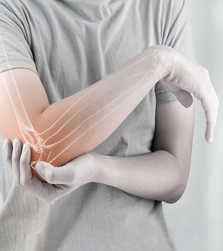 Chườm đá là một biện pháp rất hiệu quả khi bị gãy xương. Bọc đá trong một miếng vải sạch hoặc khăn và chườm lên chỗ bị đau từ 8-10 phút để giảm đau và viêm. Không sử dụng đá trực tiếp vì nó có thể gây bỏng lạnh. Trong trường hợp gãy xương, nên dùng đá chườm 2-3 lần một ngày.